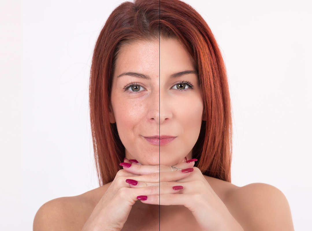 O suplemento que fortalece pele, unhas, cabelos e articulações